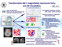 Transformácia dát z magnetickej rezonancie hlavy pre 3D vizualizáciu