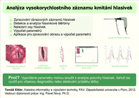 Analýza vysokorychlostního záznamu kmitání hlasivek