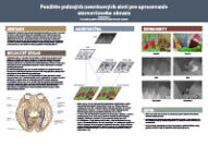 Použitie pulzných neurónových sietí pre spracovanie stereovízneho obrazu