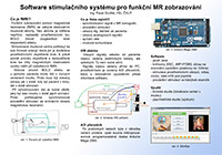 Software stimulačního systému pro funkční MR zobrazování