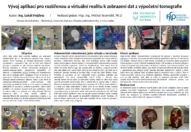 Využití rozšířené reality pro vizualizaci 3D medicínských obrazových dat