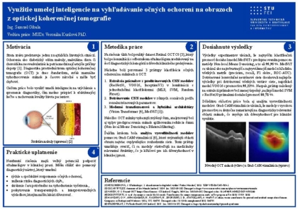 Využitie umelej inteligencie na vyhľadávanie očných
ochorení na obrazoch z optickej koherenčnej tomografie